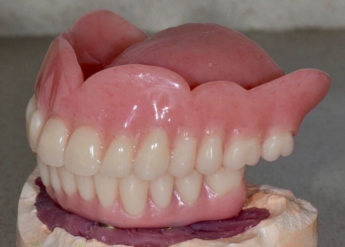What are Dentures What are Dentures