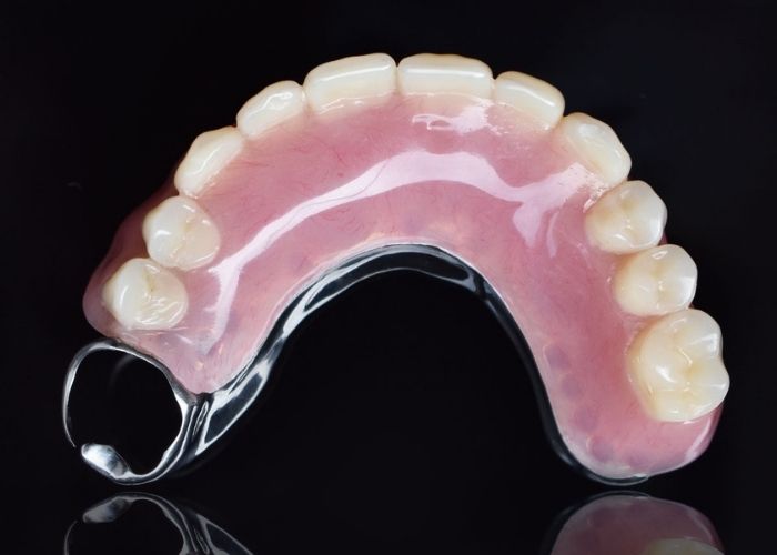 Types of dentures at Kelmscott Dental Types of dentures at Kelmscott Dental