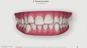 Invisalign-GO-Treatment-Plan-Dr-Mo-Soliman-Kelmscott-Dental