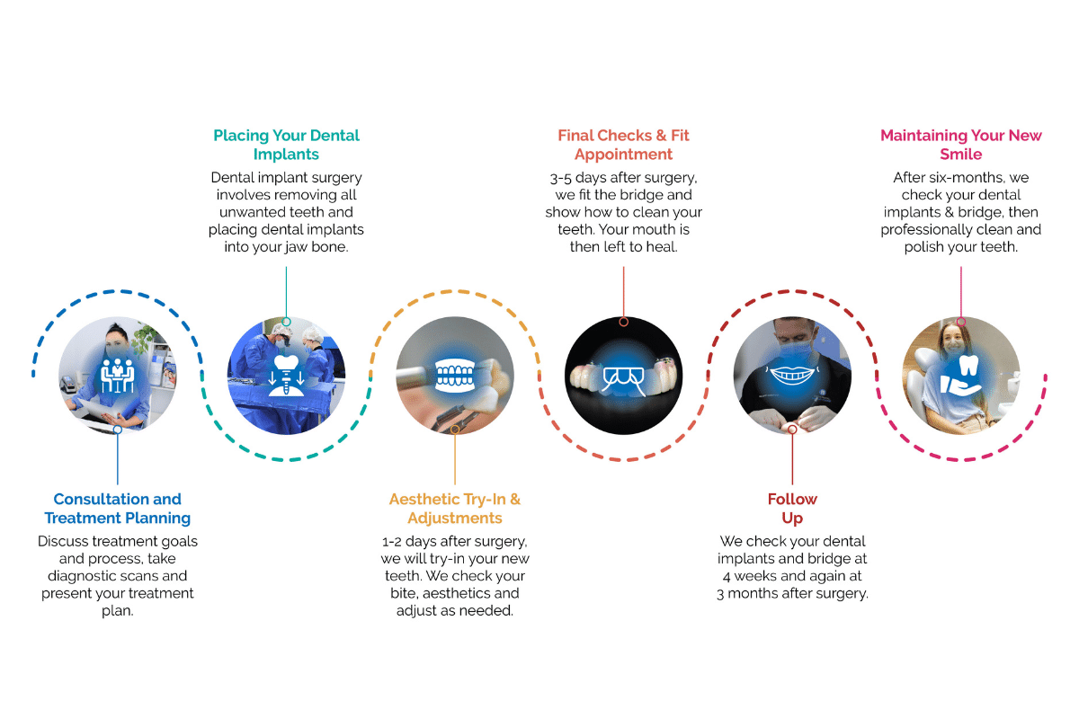 All-on-4-treatment-process